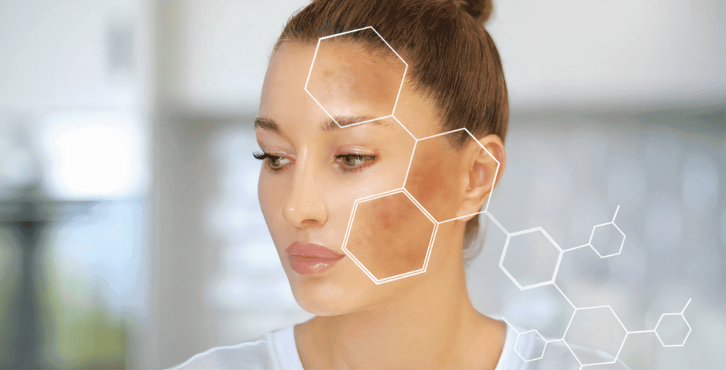 Dermalux LED Light Therapy