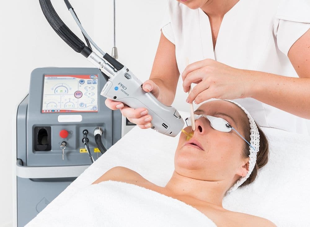 Gentle Pro Laser Treatment