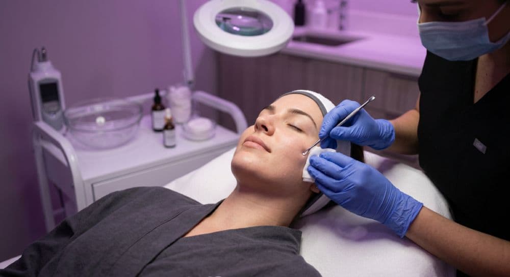 Acne Treatment