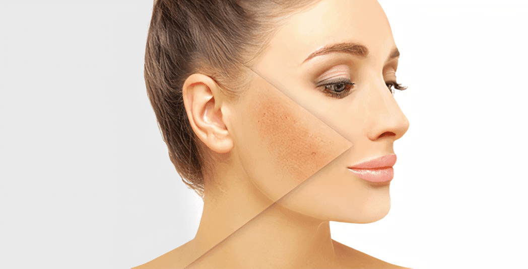 Scarring Treatment